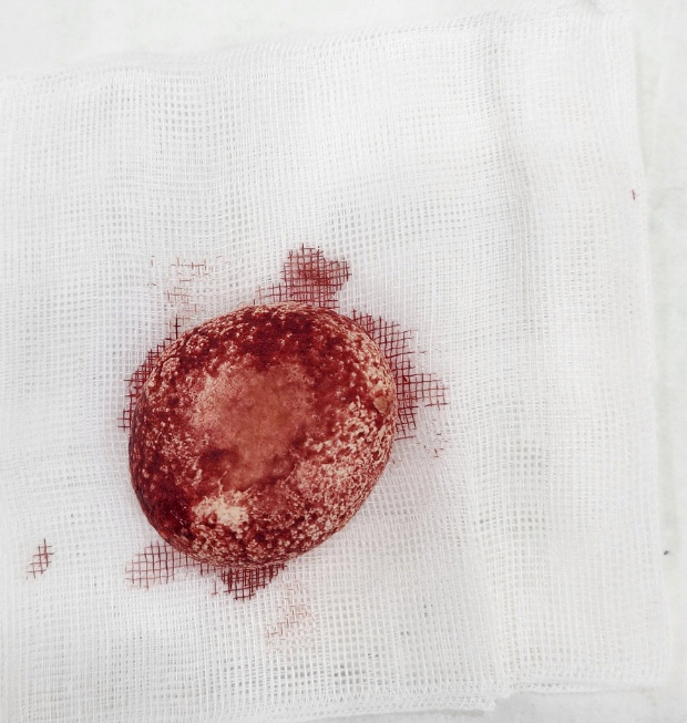 강아지 오줌에서 피가 나와요 - 강아지 방광결석