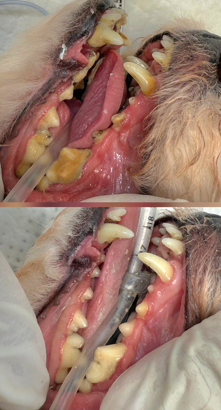 스케일링 전후사진 비교
