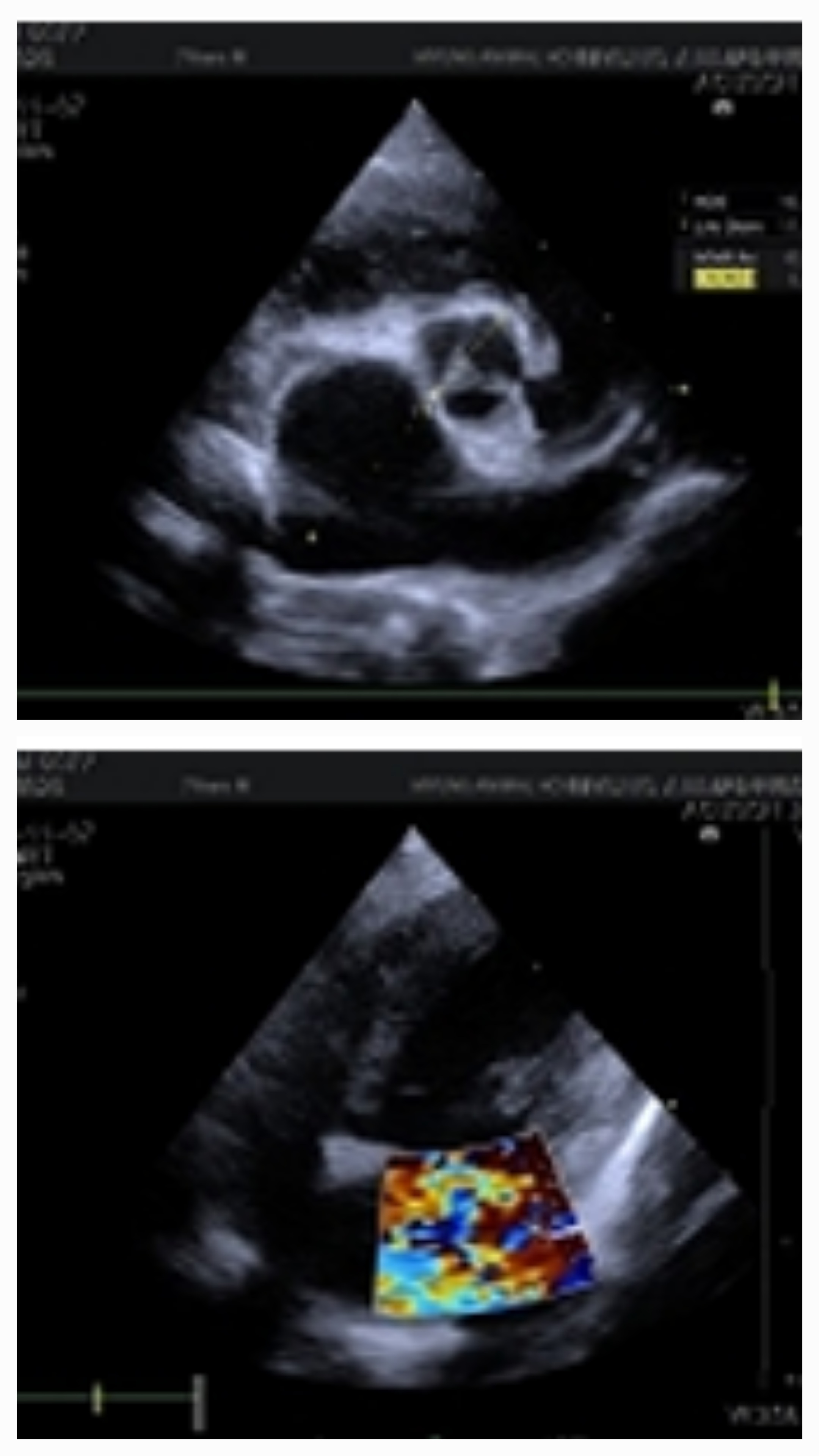 7살/10살 강아지 심장병 치료사례